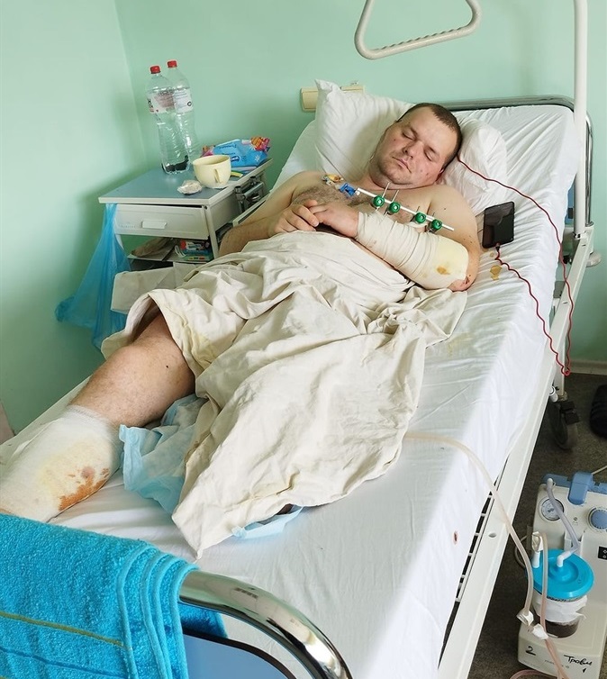 Вадим Колба на лікуванні.