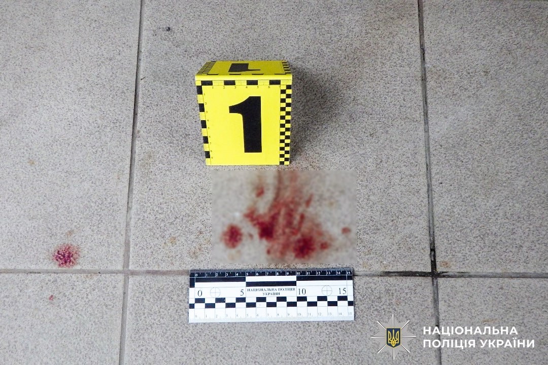 У Сарнах місцевий житель вдарив ножем знайомого у спину: потерпілого госпіталізували
